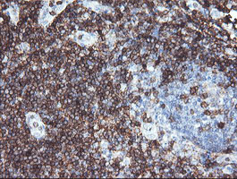 CD3E Antibody - IHC of paraffin-embedded Human tonsil using anti-CD3E mouse monoclonal antibody.