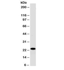 CD3E Antibody - Western blot testing of human Jurkat cell lysate with CD3e antibody (clone PC3/188A). Expected molecular weight ~23 kDa.