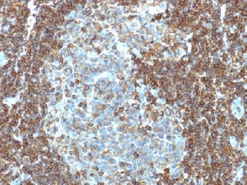 CD3E Antibody - IHC testing of human tonsil tissue with CD3e antibody (clone PC3/188A). Required HIER: boil tissue sections in 10mM citrate buffer, pH 6.0, for 10-20 min.