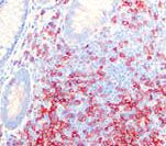 CD3E Antibody - IHC of CD3 Epsilon on FFPE Tonsil tissue.