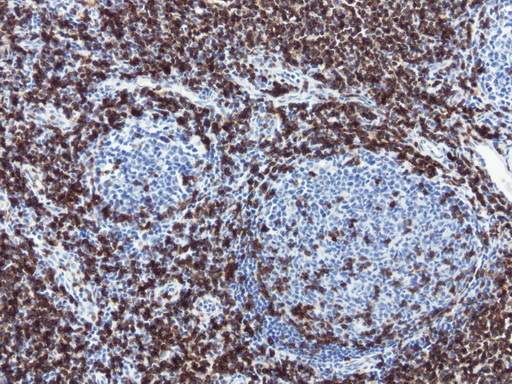 CD3E Antibody - IHC staining of FFPE human tonsil using anti-CD3E clone UMAB48 mouse monoclonal antibody at 1:200 and detection with Polink2 Broad HRP DAB.requires heat-induced epitope retrieval with Citrate pH6.O. The image shows strong membranous and cytoplasmic staining.