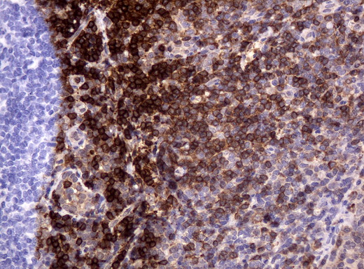 CD3E Antibody - Immunohistochemical staining of paraffin-embedded Human tonsil using anti-UM500048mouse monoclonal antibody.  heat-induced epitope retrieval by 10mM citric buffer, pH6.0, 120C for 3min)