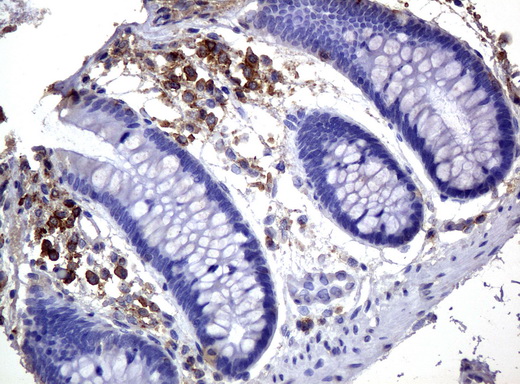 CD3E Antibody - Immunohistochemical staining of paraffin-embedded Human colon tissue using anti-UM500048 mouse monoclonal antibody.  heat-induced epitope retrieval by 10mM citric buffer, pH6.0, 120C for 3min)