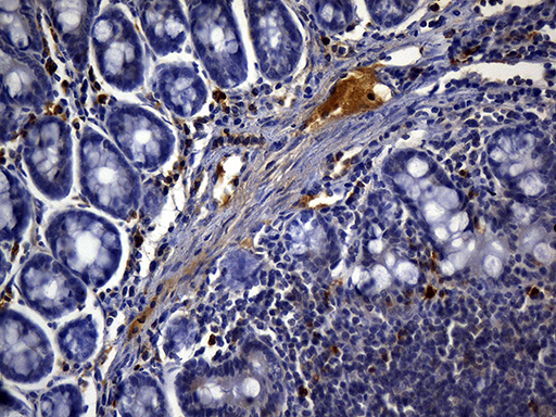 CD3E Antibody - Immunohistochemical staining of paraffin-embedded mouse ascending colon tissue using anti-CD3 clone UMAB54 mouse monoclonal antibody. (Heat-induced epitope retrieval by 1mM EDTA in 10mM Tris buffer. (pH8.5) at 120°C for 3 min. (1:300).