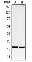 CD3E Antibody - Western blot analysis of CD3e expression in Jurkat (A); CCRFCEM (B) whole cell lysates.