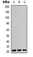 CD3E Antibody - Western blot analysis of CD3e expression in Jurkat (A); HeLa (B); NIH3T3 (C) whole cell lysates.