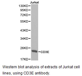 CD3E Antibody - Western blot.