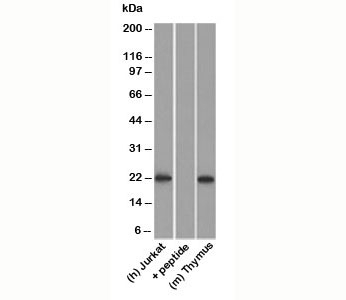 CD3E Antibody - CD3a antibody western blot.  This image was taken for the unmodified form of this product. Other forms have not been tested.