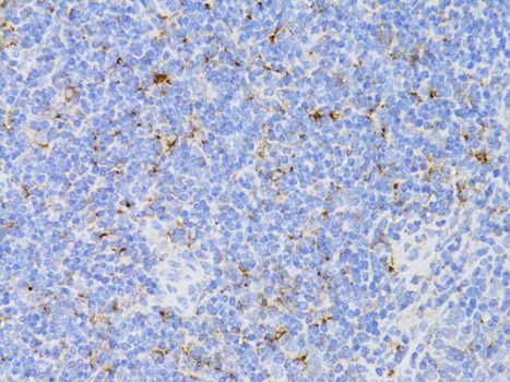 CD3E Antibody - Immunohistochemistry of paraffin-embedded mouse spleen using CD3E antibody at dilution of 1:100 (40x lens).