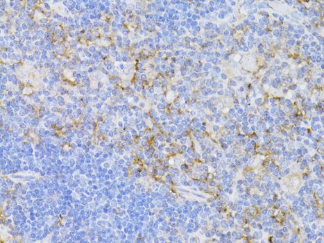 CD3E Antibody - Immunohistochemistry of paraffin-embedded mouse thymus using CD3E antibody at dilution of 1:100 (40x lens).