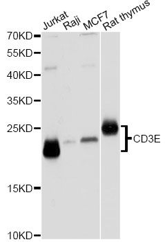 CD3E Antibody - Western blot analysis of extracts of various cell lines, using CD3E Antibody at 1:1000 dilution. The secondary antibody used was an HRP Goat Anti-Rabbit IgG (H+L) at 1:10000 dilution. Lysates were loaded 25ug per lane and 3% nonfat dry milk in TBST was used for blocking. An ECL Kit was used for detection and the exposure time was 1s.
