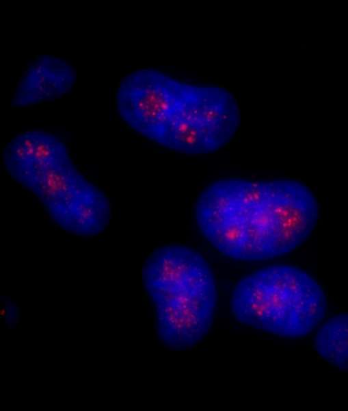 CD3EAP Antibody - Detection of Human PAF49/CAST by Immunocytochemistry. Sample: Formaldehyde-fixed asynchronous HeLa cells. Antibody: Affinity purified rabbit anti-PAF49/CAST used at a dilution of 1:125. Detection: Red-fluorescent goat anti-rabbit IgG highly cross-adsorbed Antibody used at a dilution of 1:100.