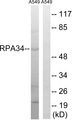 CD3EAP Antibody - Western blot analysis of lysates from A549 cells, using CD3EAP Antibody. The lane on the right is blocked with the synthesized peptide.