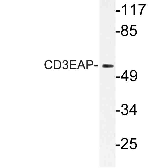 CD3EAP Antibody - Western blot of CD3EAP (E474)pAb in extracts from A549 cells.