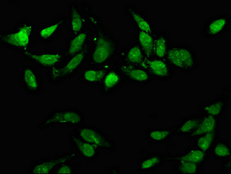 CD3EAP Antibody - Immunofluorescence staining of Hela cells at a dilution of 1:66, counter-stained with DAPI. The cells were fixed in 4% formaldehyde, permeabilized using 0.2% Triton X-100 and blocked in 10% normal Goat Serum. The cells were then incubated with the antibody overnight at 4 °C.The secondary antibody was Alexa Fluor 488-congugated AffiniPure Goat Anti-Rabbit IgG (H+L) .