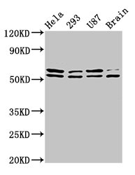 CD3EAP Antibody - Positive Western Blot detected in Hela whole cell lysate, 293 whole cell lysate,  U87 whole cell lysate,  Rat brain tissue. All lanes: CD3EAP antibody at 3.9 µg/ml Secondary Goat polyclonal to rabbit IgG at 1/50000 dilution. Predicted band size: 55, 56 KDa. Observed band size: 55, 56 KDa
