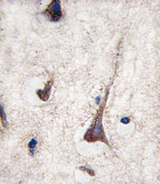 CD3G Antibody - Formalin-fixed and paraffin-embedded human brain tissue reacted with CD3G antibody , which was peroxidase-conjugated to the secondary antibody, followed by DAB staining. This data demonstrates the use of this antibody for immunohistochemistry; clinical relevance has not been evaluated.