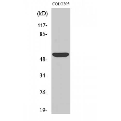 CD4 Antibody - Western blot of CD4 antibody