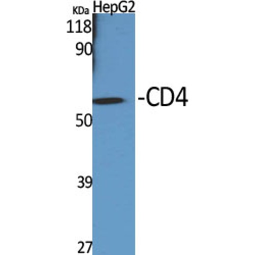 CD4 Antibody - Western blot of CD4 antibody