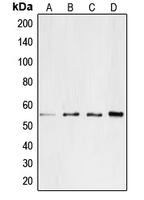 CD4 Antibody - Western blot analysis of CD4 expression in Jurkat (A); SP2/0 (B); PC12 (C); H9C2 (D) whole cell lysates.