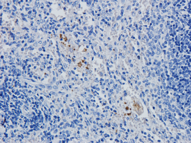 CD4 Antibody - WB on mouse-derived tissues.
