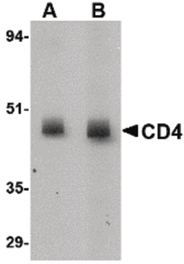 CD4 Antibody - Western blot of CD4 in rat lung tissue lysate with CD4 antibody at (A) 0.5 and (B) 1 ug/ml.
