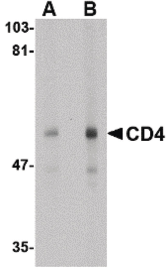 CD4 Antibody - Western blot of CD4 in human thymus tissue lysate with CD4 antibody at (A) 0.5 and (B) 1 ug/ml.