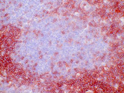 CD4 Antibody - Clone EDU-2 Biotin human tonsil, frozen section