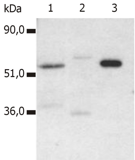 CD4 Antibody - Immunoprecipitation of human CD4 from the lysate T cells isolated from fresh buffy coats. Western blot was immunostained by anti-human CD4 (MEM-241). Lane 1: original lysate of T cells Lane 2: immunoprecipitate by negative control antibody Lane 3: immunoprecipitate by anti-human CD4 (MEM-115)