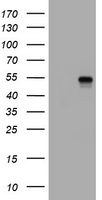 CD4 Antibody - HEK293T cells were transfected with the pCMV6-ENTRY control (Left lane) or pCMV6-ENTRY CD4 (Right lane) cDNA for 48 hrs and lysed. Equivalent amounts of cell lysates (5 ug per lane) were separated by SDS-PAGE and immunoblotted with anti-CD4.