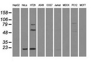 CD4 Antibody - Western blot of extracts (35 ug) from 9 different cell lines by using anti-CD4 monoclonal antibody.