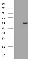 CD4 Antibody - HEK293T cells were transfected with the pCMV6-ENTRY control (Left lane) or pCMV6-ENTRY CD4(Right lane) cDNA for 48 hrs and lysed. Equivalent amounts of cell lysates (5 ug per lane) were separated by SDS-PAGE and immunoblotted with anti-CD4.