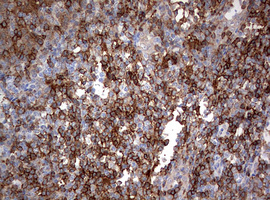 CD4 Antibody - IHC of paraffin-embedded Human lymph node tissue using anti-CD4 mouse monoclonal antibody. (Heat-induced epitope retrieval by 10mM citric buffer, pH6.0, 120°C for 3min).