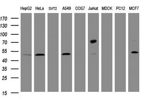 CD4 Antibody - Western blot of extracts (35ug) from 9 different cell lines by using anti-CD4 monoclonal antibody (HepG2: human; HeLa: human; SVT2: mouse; A549: human; COS7: monkey; Jurkat: human; MDCK: canine; PC12: rat; MCF7: human).