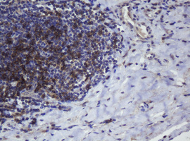 CD4 Antibody - IHC of paraffin-embedded Human lymph node tissue using anti-CD4 mouse monoclonal antibody. (Heat-induced epitope retrieval by 10mM citric buffer, pH6.0, 120°C for 3min).