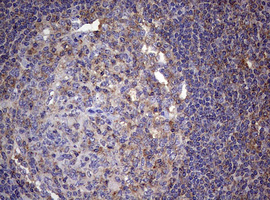 CD4 Antibody - IHC of paraffin-embedded Human tonsil using anti-CD4 mouse monoclonal antibody. (Heat-induced epitope retrieval by 10mM citric buffer, pH6.0, 120°C for 3min).