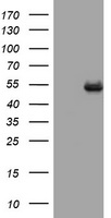 CD4 Antibody - HEK293T cells were transfected with the pCMV6-ENTRY control (Left lane) or pCMV6-ENTRY ${SYMBOL} (${RC_SKU}, Right lane) cDNA for 48 hrs and lysed. Equivalent amounts of cell lysates (5 ug per lane) were separated by SDS-PAGE and immunoblotted with anti-${SYMBOL}.