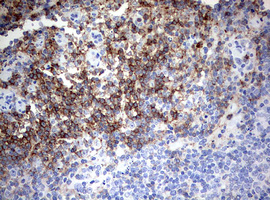 Anti-CD4 Antibody | Mouse anti-Human Monoclonal IHC,WB | LSBio