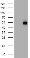 CD4 Antibody - HEK293T cells were transfected with the pCMV6-ENTRY control (Left lane) or pCMV6-ENTRY CD4 (Right lane) cDNA for 48 hrs and lysed. Equivalent amounts of cell lysates (5 ug per lane) were separated by SDS-PAGE and immunoblotted with anti-CD4.