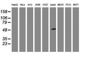 CD4 Antibody - Western blot of extracts (35 ug) from 9 different cell lines by using g anti-CD4 monoclonal antibody (HepG2: human; HeLa: human; SVT2: mouse; A549: human; COS7: monkey; Jurkat: human; MDCK: canine; PC12: rat; MCF7: human).