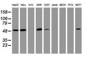 CD4 Antibody - Western blot of extracts (35 ug) from 9 different cell lines by using anti-CD4 monoclonal antibody (HepG2: human; HeLa: human; SVT2: mouse; A549: human; COS7: monkey; Jurkat: human; MDCK: canine; PC12: rat; MCF7: human).