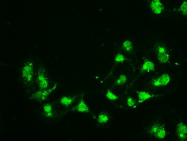 CD4 Antibody - Immunofluorescent staining of COS7 cells using anti-CD4 mouse monoclonal antibody.