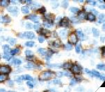 CD4 Antibody - IHC of CD4 on FFPE Tonsil tissue. This image was taken for the unmodified form of this product. Other forms have not been tested.