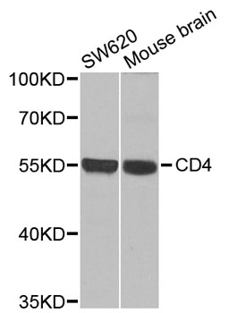 CD4 Antibody - Western blot analysis of extracts of various cell lines, using CD4 antibody at 1:1000 dilution. The secondary antibody used was an HRP Goat Anti-Rabbit IgG (H+L) at 1:10000 dilution. Lysates were loaded 25ug per lane and 3% nonfat dry milk in TBST was used for blocking. An ECL Kit was used for detection and the exposure time was 30s.