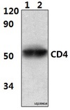 CD4 Antibody - Western blot of CD4 (10H8) mAb at 1:1000 dilution. Lane 1: Jurkat whole cell lysate (30 ug.
