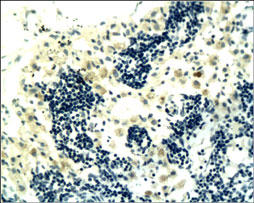 CD4 Antibody - CD4 staining in rat pancreas. Paraffin-embedded rat pancreas stained with CD4 Antibody used at 1:30 dilution.