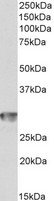 CD4 Antibody - CD4 antibody (1µg/ml) staining of Human Spleen lysate (35µg protein in RIPA buffer). Detected by chemiluminescence.
