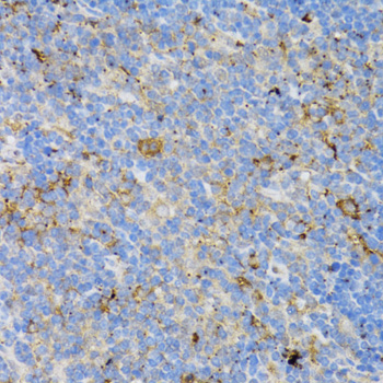 CD4 Antibody - Immunohistochemistry of paraffin-embedded mouse thymus using CD4 antibody at dilution of 1:100 (40x lens).