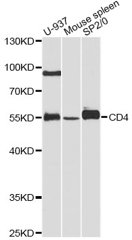 CD4 Antibody - Western blot analysis of extracts of various cell lines, using CD4 antibody at 1:1000 dilution. The secondary antibody used was an HRP Goat Anti-Rabbit IgG (H+L) at 1:10000 dilution. Lysates were loaded 25ug per lane and 3% nonfat dry milk in TBST was used for blocking. An ECL Kit was used for detection and the exposure time was 90s.