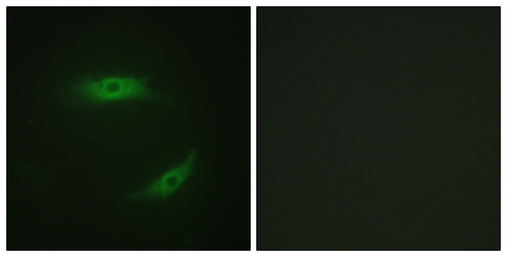 CD4 Antibody - Immunofluorescence analysis of HepG2 cells, using CD4 (Phospho-Ser433) Antibody. The picture on the right is blocked with the phospho peptide.